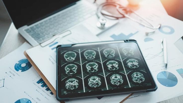 Andrea Celli (Philips): "L’intelligenza artificiale può aiutare a salvare vite umane"
