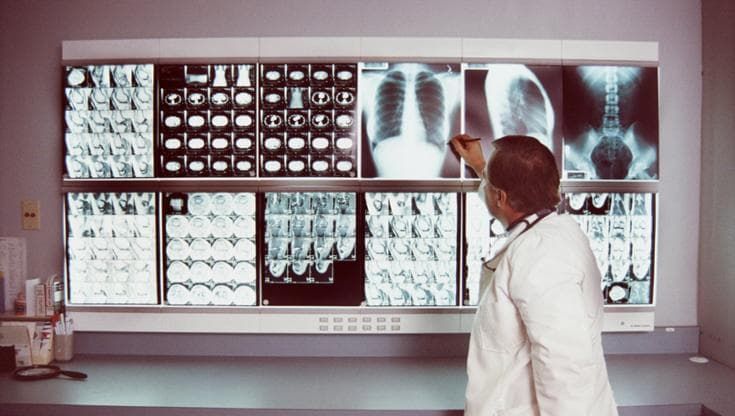 Radiologia geriatrica, arriva l’aiuto dell’Ai per esami superflui e liste d’attesa