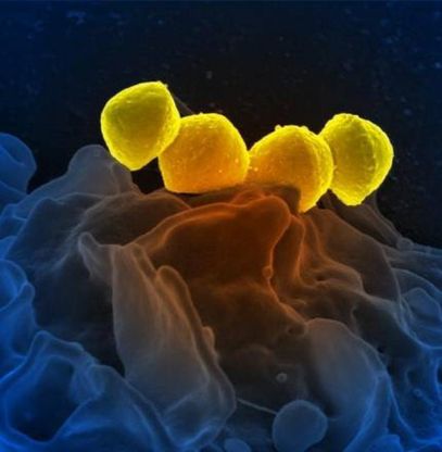 In crescita le infezioni da streptococco: colpiscono a ogni et&agrave;, dalla gola all'anca