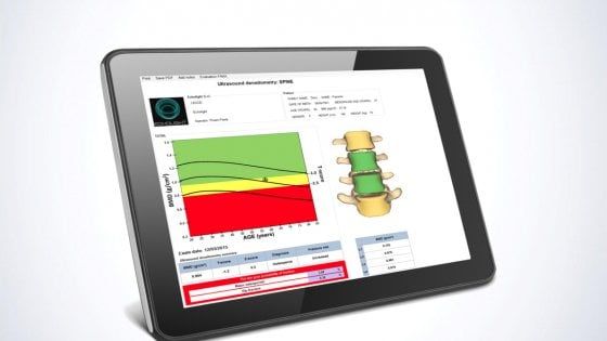 Un’ecografia per scovare l’osteoporosi, Echolight ottiene un finanziamento da 4 milioni