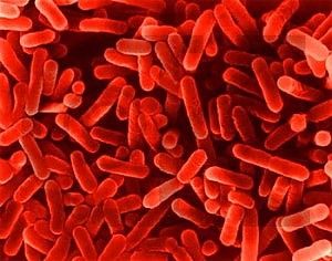 Sfollata per il terremoto<br />muore di legionellosi