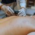 Melanoma: le sfide della prevenzione e i nuovi bisogni dei pazienti