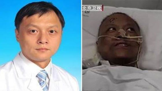 Due medici cinesi contagiati dal virus si risvegliano con la pelle scura