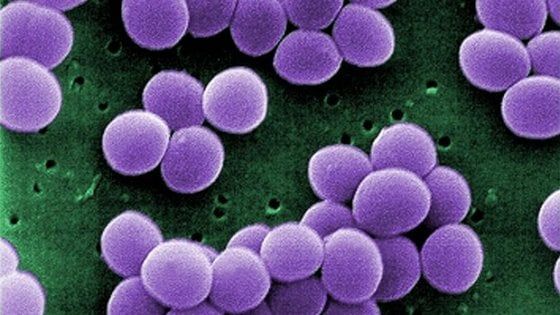 'Batteri da incubo' che resistono a tutto, scoperti 221 casi negli Usa