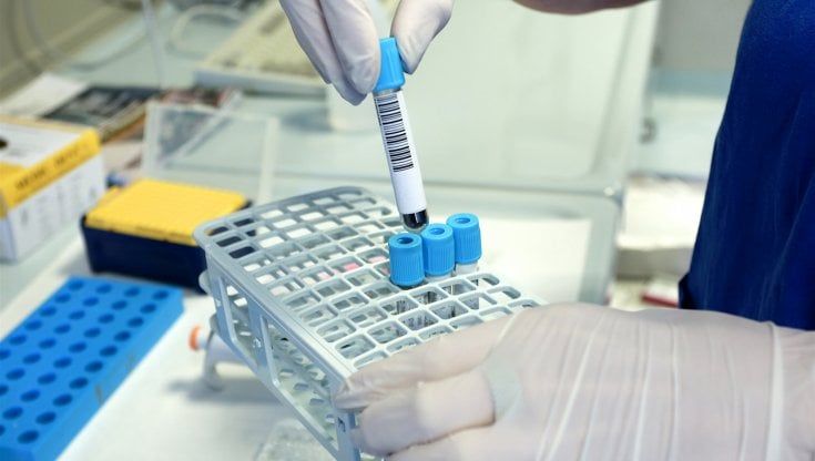 Scoperta una sindrome ultrarara che colpisce articolazioni, pelle e apparato cardiovascolare