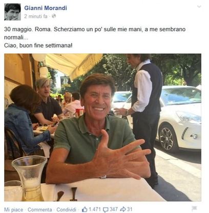 Morandi autoironico: "Le mie mani? A me sembrano normali...". E i fan si scatenano