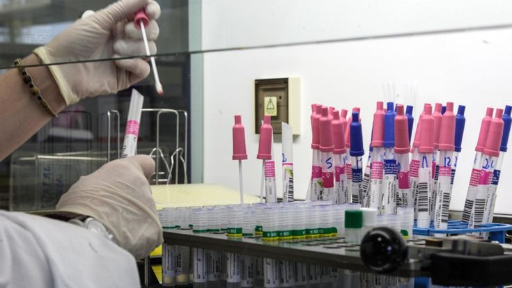 Prezzi fermi, fabbriche condivise e priorità allo Stato: il patto tra le imprese delle macchine anti-coronavirus