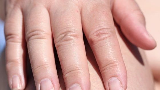 Che cosa saranno le macchie sulla pelle del paziente di Sansilvestro?