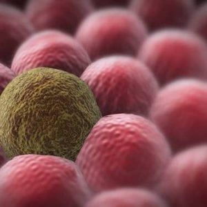 Cellule tumorali capaci di vivere senza zucchero, scoperto possibile meccanismo farmacoresistenza
