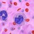 Leucemia mieloide cronica, agire subito per vivere più a lungo