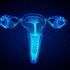 Endometriosi, un dolore da non sottovalutare