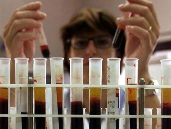 Hiv, ricercatori italiani scoprono "la porta di casa" del virus