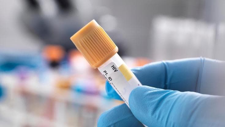 Hiv, la Prep a lunga durata anche in Italia: potrebbe migliorare l’aderenza alla terapia