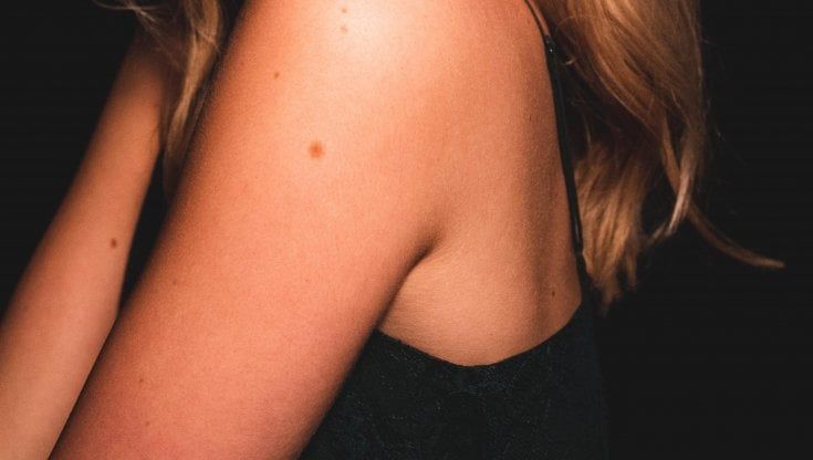 Un decalogo per migliorare la diagnosi precoce del melanoma