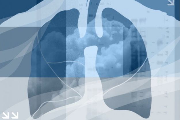Tumore polmone, rivoluzione nella diagnosi: presto baster&agrave; un test del respiro