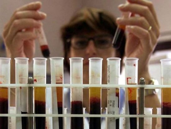Aids, "Scoperta una sostanza che agisce come uno scudo anti-hiv sulle scimmie"