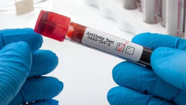 Long Covid: un test del sangue svela chi rischia di più