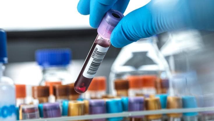 Diabete di tipo 2: una molecola con tre bersagli per controllare la malattia e perdere peso