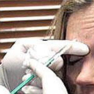 Inchiesta sul botulino: reazioni anche gravi nell'uso cosmetico