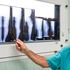 Robot e software innovativi, così la chirurgia del ginocchio diventa su misura