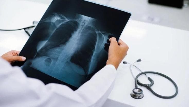 Abusi su una ragazza mentre fa la radiografia, condannato il tecnico. Ma lui continua a lavorare