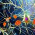 Le alterazioni della microglia possono contribuire allo sviluppo delle malattie neurodegenerative