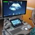 Displasia ectodermica ipoidrotica: al Policlinico di Milano il primo trattamento in utero in Italia