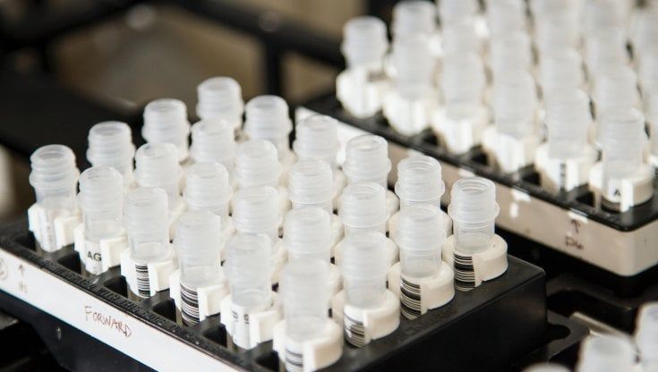  Tumore del seno, l’Emilia-Romagna rende disponibili i test genomici