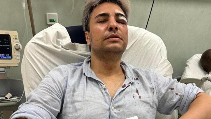 Aggressione omofoba in centro a Roma: tre minorenni finiscono ai domiciliari