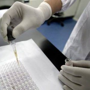 Un farmaco anti-colesterolo sperimentato per curare il tumore alla prostata