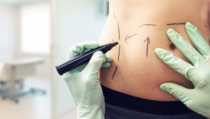 Chirurgia plastica, l'esperto: "A Natale il "ritocchino" è tra i regali più desiderati"